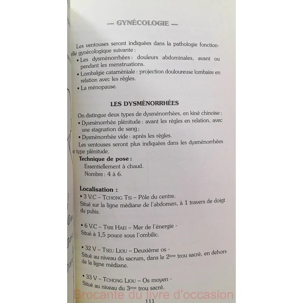 La médecine des ventouses