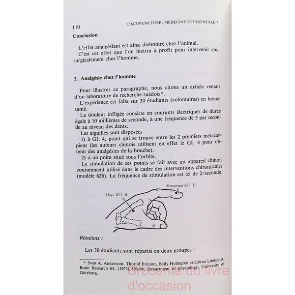 L'acupuncture, médecine occidentale ?