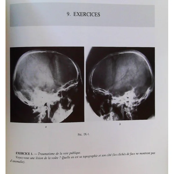 Le Crane (Cahiers de radiologie .)