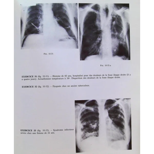 Le Poumon (Cahiers de radiologie)