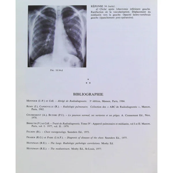Le Poumon (Cahiers de radiologie)